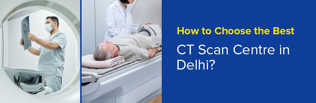 How to Choose the Best CT Scan Centre in Delhi?
